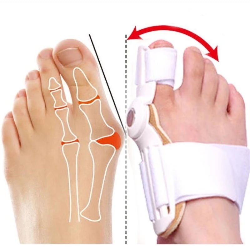 Corretor Ortopédico para Joanetes Confort™